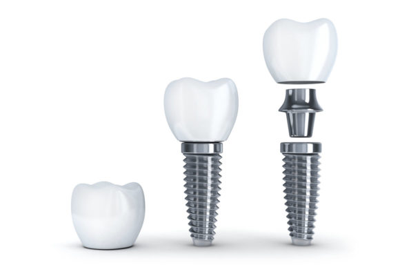 dental blog